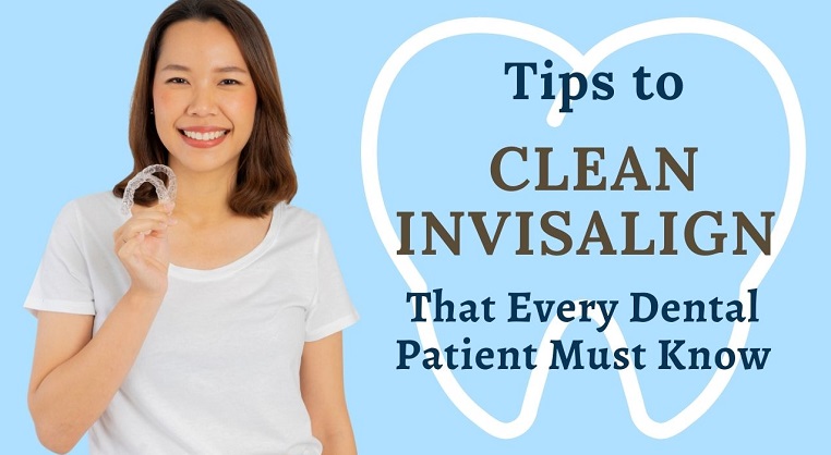 Top 5 Tips to Clean Invisalign That Every Dental Patient Must Know