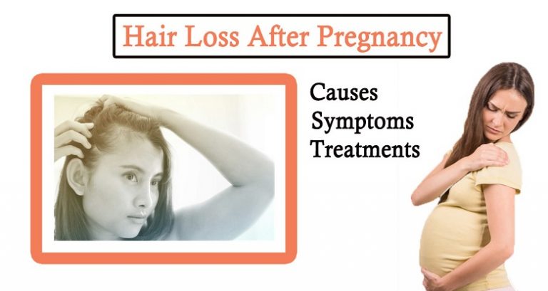 Hair Loss After Pregnancy Causes Symptoms And Treatments 8521