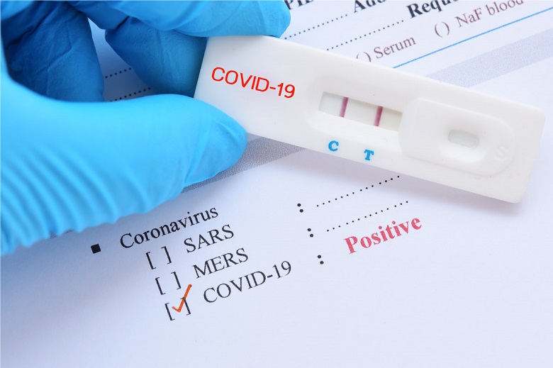 COVID 19 Positive Test Result